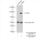 CLPTM1 Antibody in Immunoprecipitation (IP)