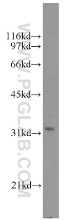 MED6 Antibody in Western Blot (WB)