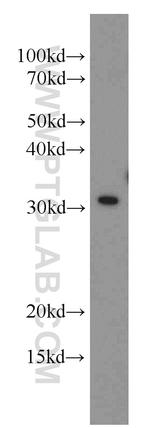 MED6 Antibody in Western Blot (WB)