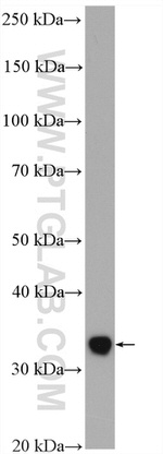 MED6 Antibody in Western Blot (WB)