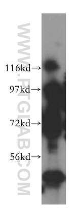 POLR3D Antibody in Western Blot (WB)