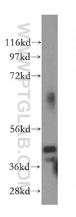 POLR3D Antibody in Western Blot (WB)