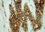 CHST12 Antibody in Immunohistochemistry (Paraffin) (IHC (P))