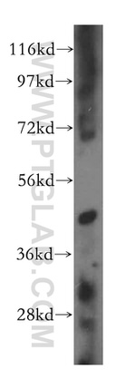 CHST12 Antibody in Western Blot (WB)