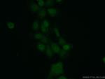 MAD2L1BP Antibody in Immunocytochemistry (ICC/IF)