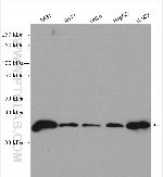 MAD2L1BP Antibody in Western Blot (WB)