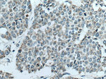 CKMT1A Antibody in Immunohistochemistry (Paraffin) (IHC (P))