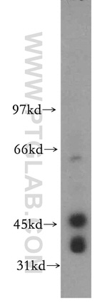 CKMT1A Antibody in Western Blot (WB)