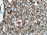 CKMT1A Antibody in Immunohistochemistry (Paraffin) (IHC (P))