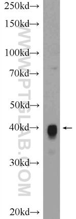 CKMT1A Antibody in Western Blot (WB)