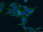 CRIP1 Antibody in Immunocytochemistry (ICC/IF)