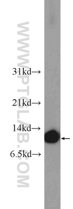 CRIP1 Antibody in Western Blot (WB)
