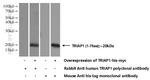 TRIAP1 Antibody in Western Blot (WB)
