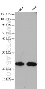 MED18 Antibody in Western Blot (WB)
