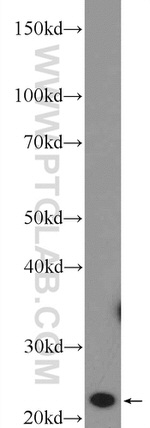 MED18 Antibody in Western Blot (WB)