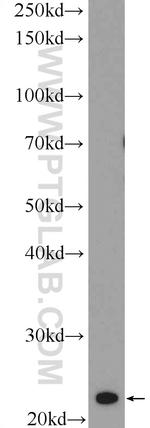 MED18 Antibody in Western Blot (WB)