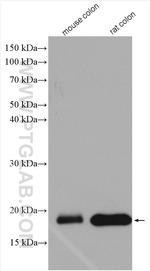 MYL9 Antibody in Western Blot (WB)