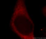 RPS27 Antibody in Immunocytochemistry (ICC/IF)