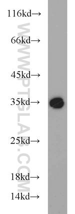 RLBP1 Antibody in Western Blot (WB)