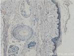 ST6GALNAC1 Antibody in Immunohistochemistry (Paraffin) (IHC (P))