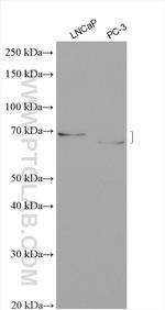 ST6GALNAC1 Antibody in Western Blot (WB)