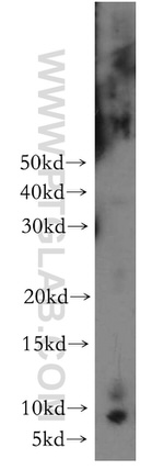 COX8A Antibody in Western Blot (WB)