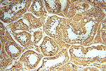 NFS1 Antibody in Immunohistochemistry (Paraffin) (IHC (P))