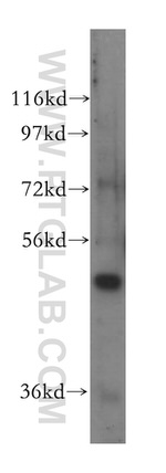 NFS1 Antibody in Western Blot (WB)