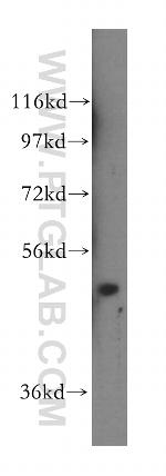 NFS1 Antibody in Western Blot (WB)