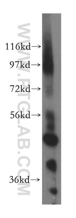 NFS1 Antibody in Western Blot (WB)