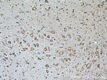 GLRB Antibody in Immunohistochemistry (Paraffin) (IHC (P))