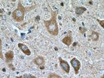 GLRB Antibody in Immunohistochemistry (Paraffin) (IHC (P))