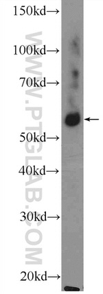 GLRB Antibody in Western Blot (WB)