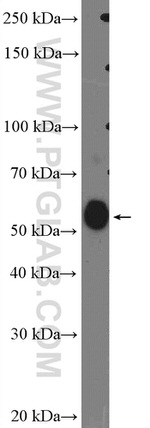 GLRB Antibody in Western Blot (WB)