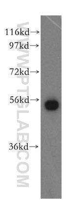 SPTLC1 Antibody in Western Blot (WB)