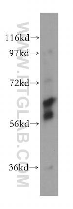 CES2 Antibody in Western Blot (WB)