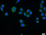 SURF1 Antibody in Immunocytochemistry (ICC/IF)