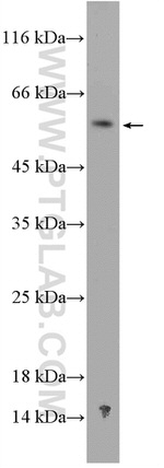 NDP Antibody in Western Blot (WB)