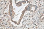 CEL Antibody in Immunohistochemistry (Paraffin) (IHC (P))
