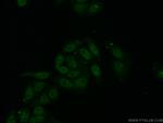 RPL6 Antibody in Immunocytochemistry (ICC/IF)