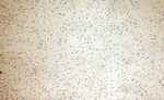 BRCC3 Antibody in Immunohistochemistry (Paraffin) (IHC (P))