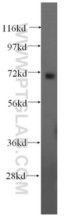 BRCC3 Antibody in Western Blot (WB)