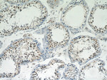 PRMT6 Antibody in Immunohistochemistry (Paraffin) (IHC (P))
