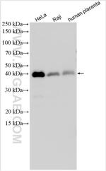 NR2F6 Antibody in Western Blot (WB)