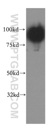 SATB1 Antibody in Western Blot (WB)