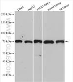 USP30 Antibody in Western Blot (WB)
