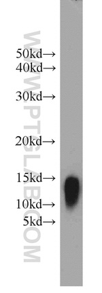 YPEL3 Antibody in Western Blot (WB)
