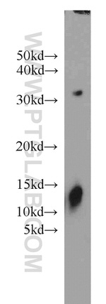 YPEL3 Antibody in Western Blot (WB)