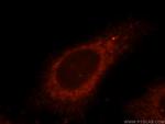 USP2 Antibody in Immunocytochemistry (ICC/IF)