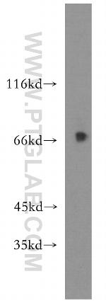 USP2 Antibody in Western Blot (WB)